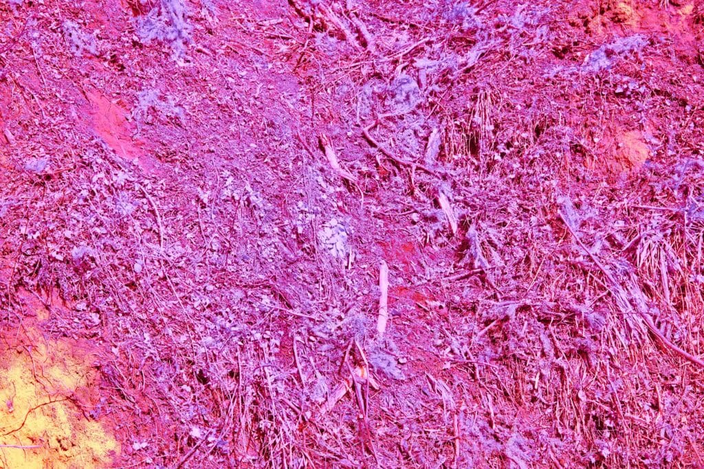 Tumore del colon sotto i 50 anni: segnali da non sottovalutare e importanza dello screening precoce