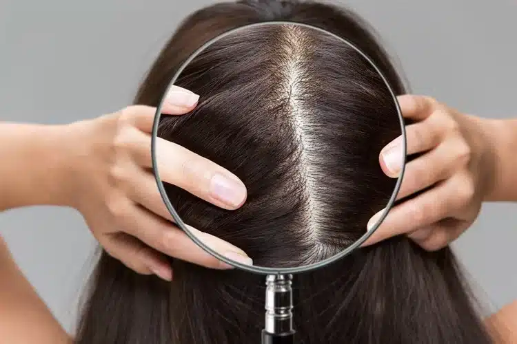 Il cuoio capelluto è la nuova pelle: perché oggi i capelli si curano partendo da lì